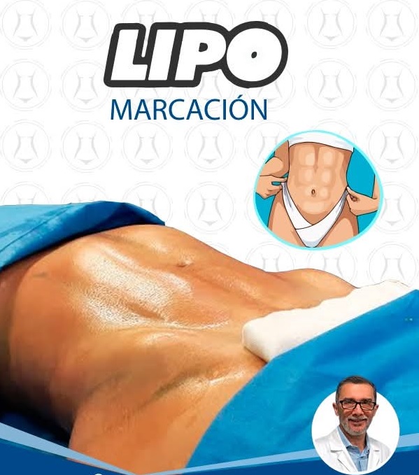 Lipomarcación